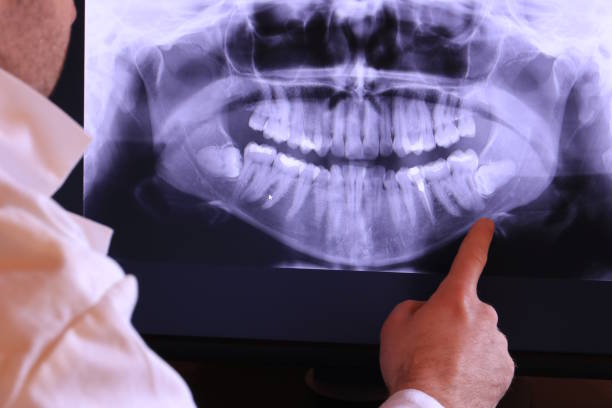 Best Emergency Dentist for Lost Fillings or Crowns in Blackwell, OK