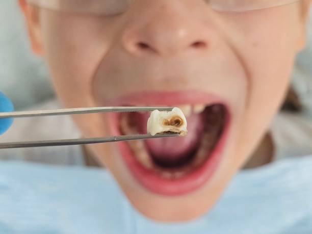 Best Urgent Dental Care for Toothache in Blackwell, OK