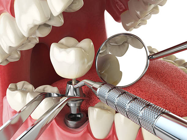 Best Emergency Dental Services for Seniors in Blackwell, OK
